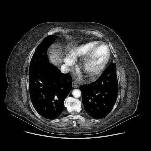 Generated VENOUS CT scan (A→B translation)