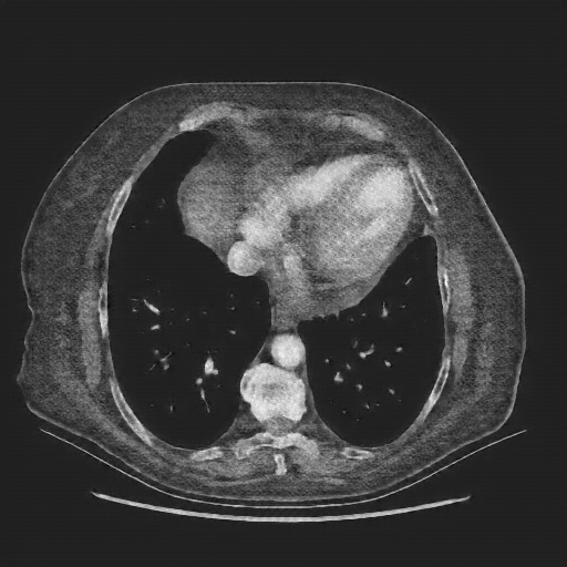 Generated VENOUS CT scan (A→B translation)