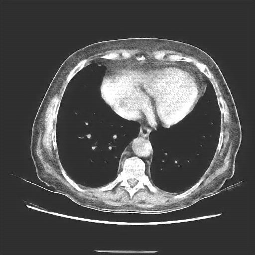 Generated VENOUS CT scan (A→B translation)