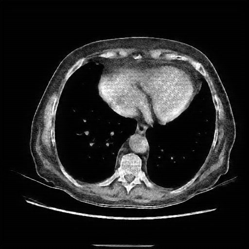 Generated VENOUS CT scan (A→B translation)