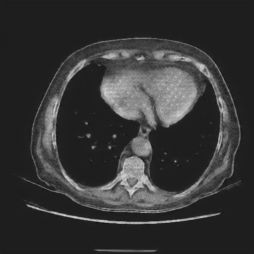 Generated VENOUS CT scan (A→B translation)