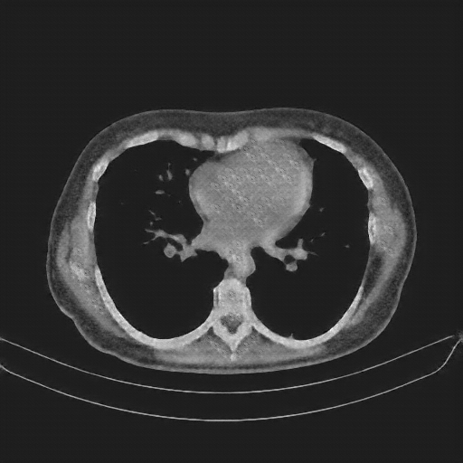 Generated VENOUS CT scan (A→B translation)