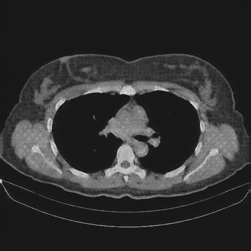 Generated VENOUS CT scan (A→B translation)