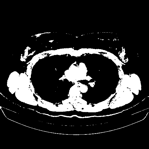 Reconstructed NATIVE CT scan (cycle consistency)