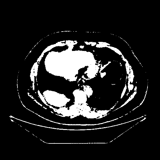 Original VENOUS CT scan