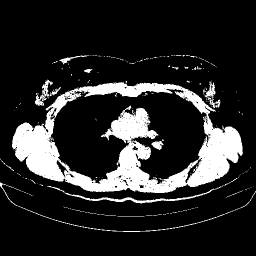 Original NATIVE CT scan (input)