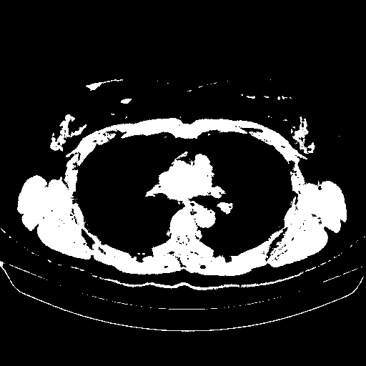 Original VENOUS CT scan