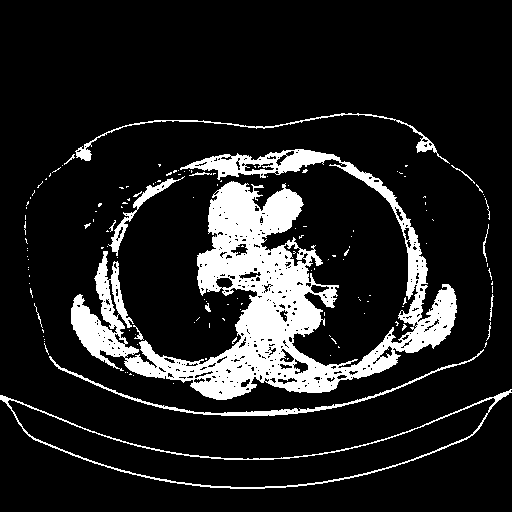 Original VENOUS CT scan