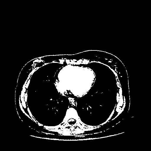 Original VENOUS CT scan