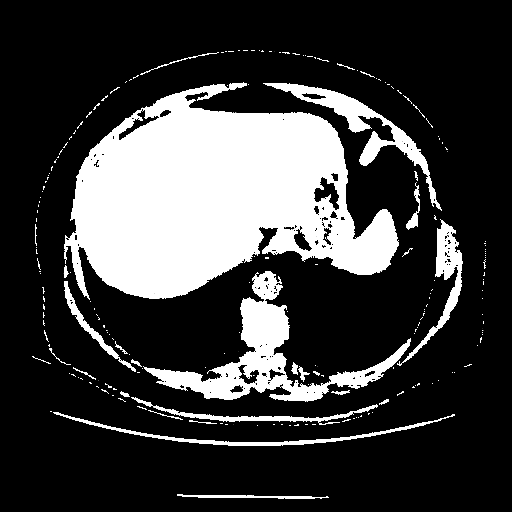 Original VENOUS CT scan