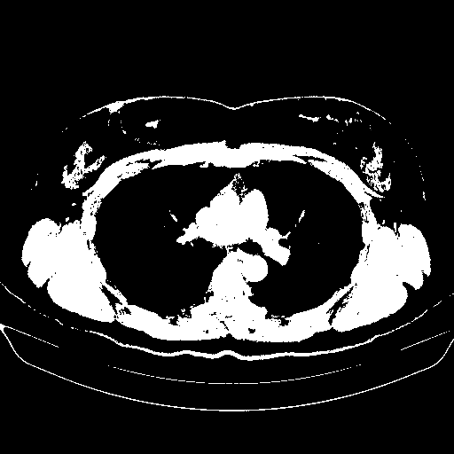 Generated VENOUS CT scan (A→B translation)