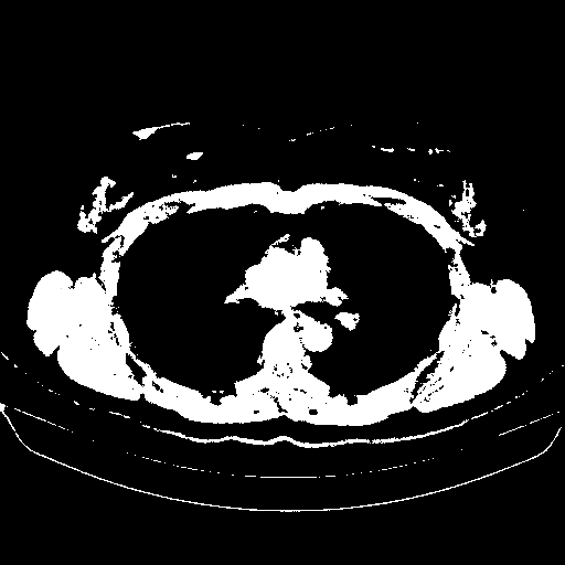 Original VENOUS CT scan