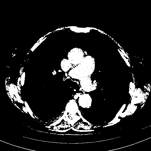 Original NATIVE CT scan (input)