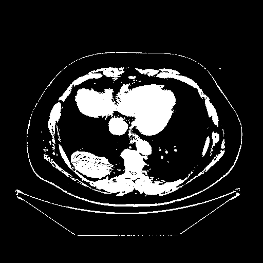 Generated VENOUS CT scan (A→B translation)