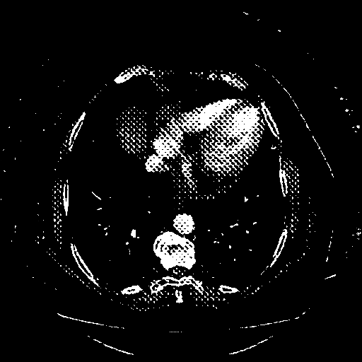 Reconstructed NATIVE CT scan (cycle consistency)