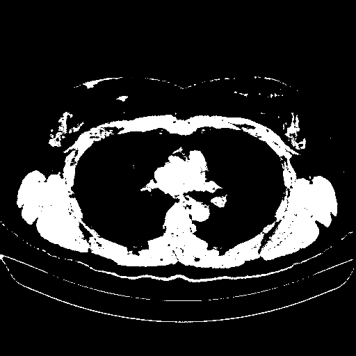 Original VENOUS CT scan