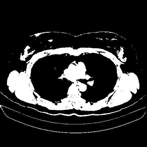 Reconstructed NATIVE CT scan (cycle consistency)