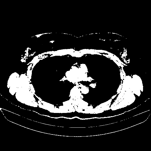 Original VENOUS CT scan