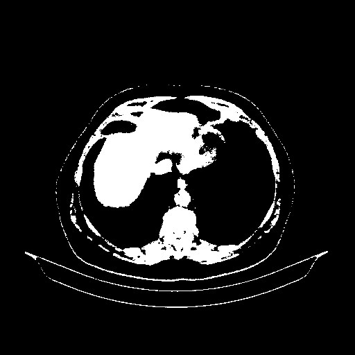 Original VENOUS CT scan