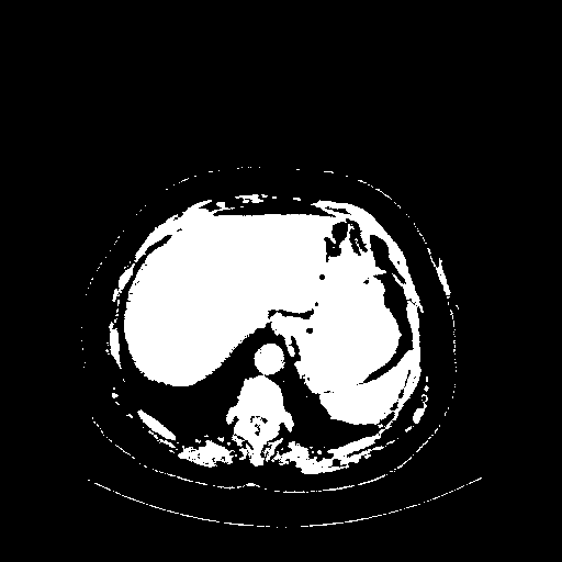 Original VENOUS CT scan