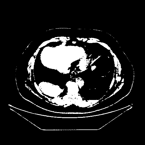 Original VENOUS CT scan