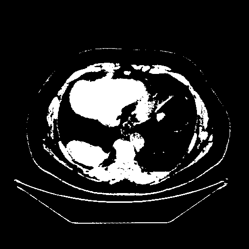 Original VENOUS CT scan