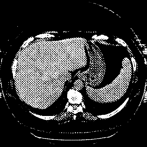 Reconstructed NATIVE CT scan (cycle consistency)