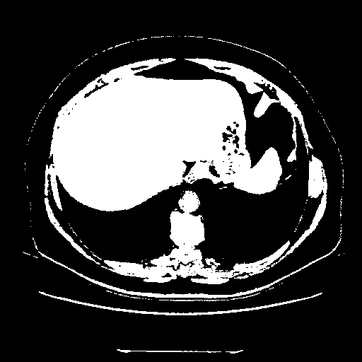 Original VENOUS CT scan