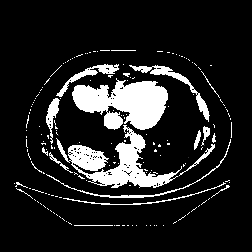 Generated VENOUS CT scan (A→B translation)
