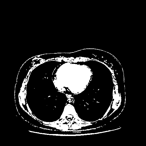 Original VENOUS CT scan