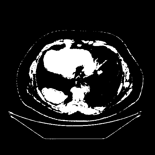 Original VENOUS CT scan