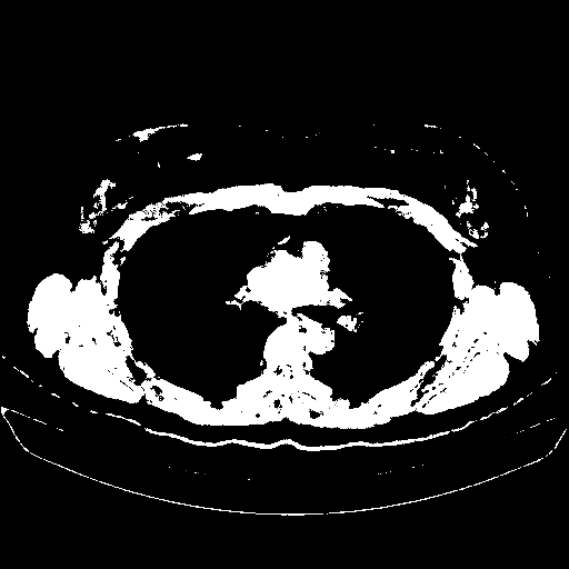 Original VENOUS CT scan