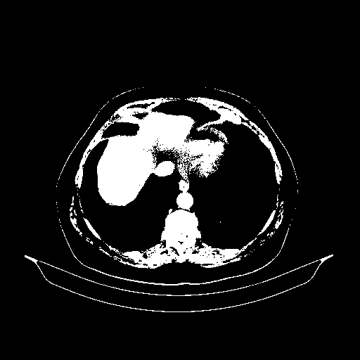 Generated VENOUS CT scan (A→B translation)
