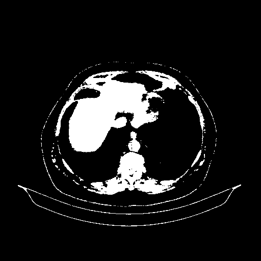 Reconstructed NATIVE CT scan (cycle consistency)