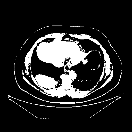 Generated VENOUS CT scan (A→B translation)
