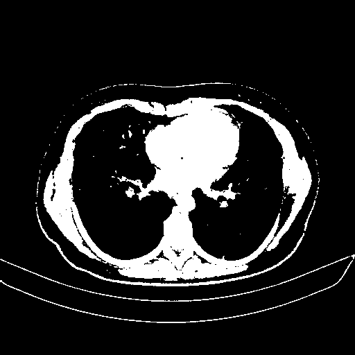 Generated VENOUS CT scan (A→B translation)
