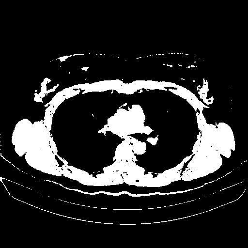 Generated VENOUS CT scan (A→B translation)