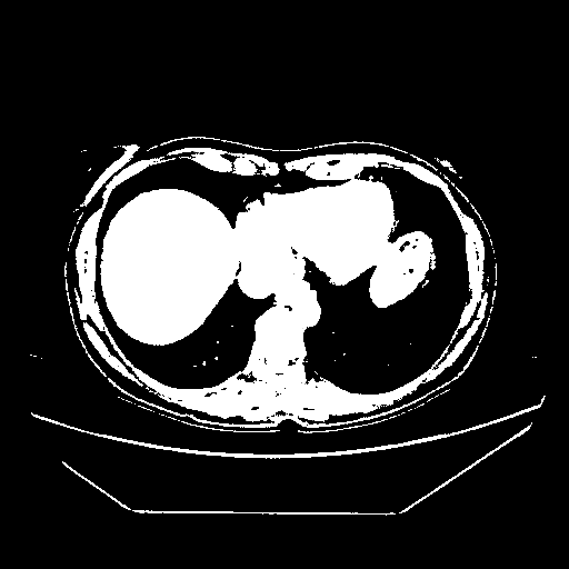 Generated VENOUS CT scan (A→B translation)