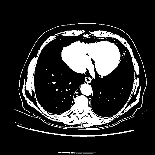 Generated VENOUS CT scan (A→B translation)