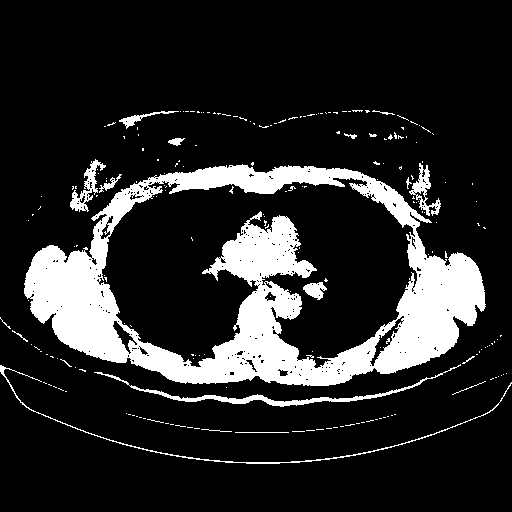 Original NATIVE CT scan (input)