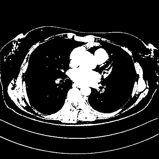 Generated VENOUS CT scan (A→B translation)