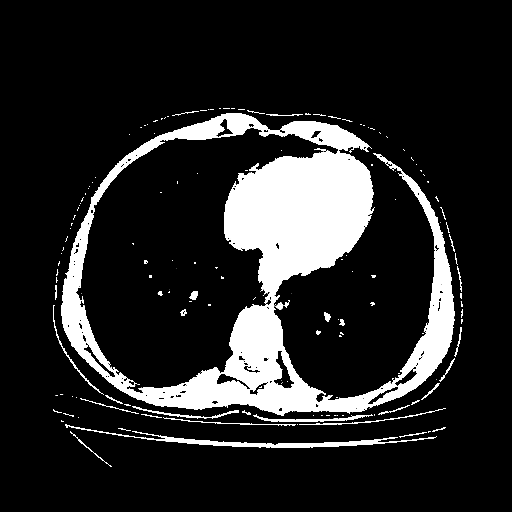 Generated VENOUS CT scan (A→B translation)