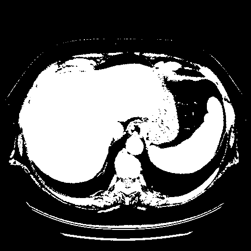 Original VENOUS CT scan